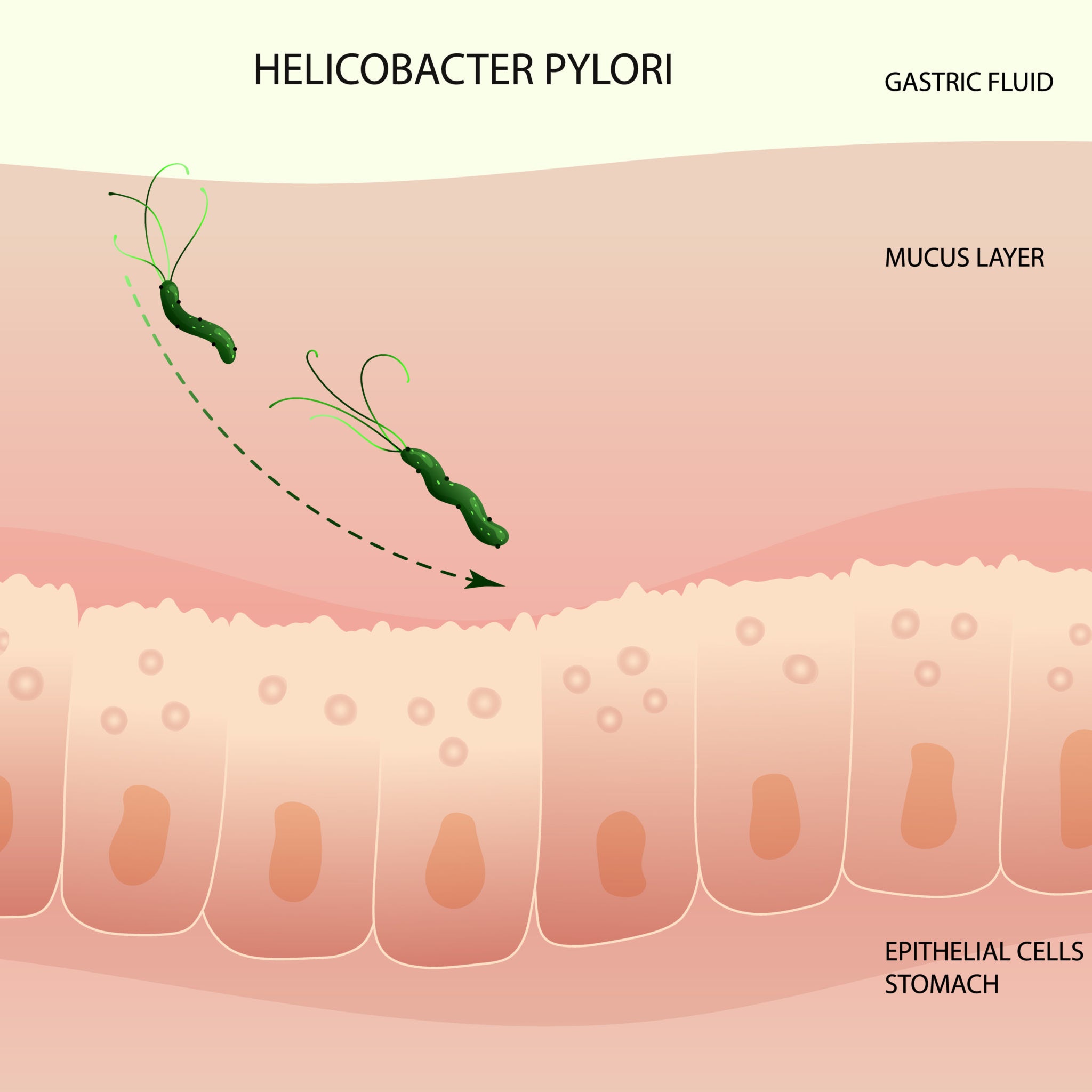 imagen helicobacter